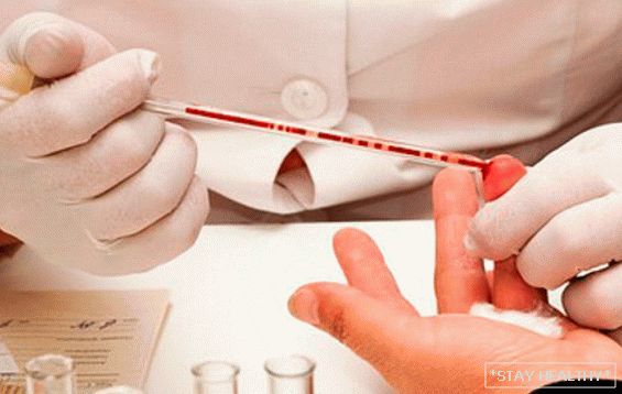 Es posible beber agua antes de donar sangre aanaliza Recomendaciones de expertos: si beber agua antes de la entrega.de sangre