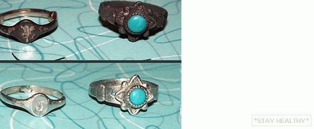 Почему почернело серебряное кольцо. Почернение серебряных изделий. Серебряные украшения до и после очистки. Потемневшее серебро. Серебро до и после.