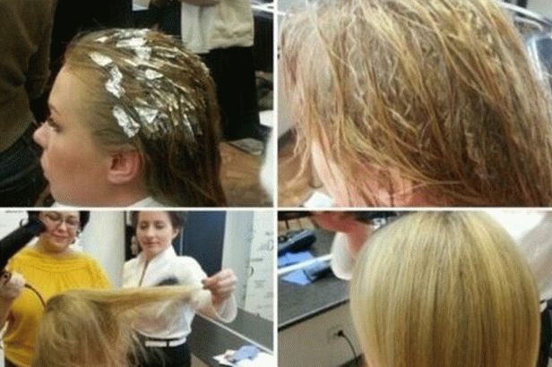 aumento del volumen basal