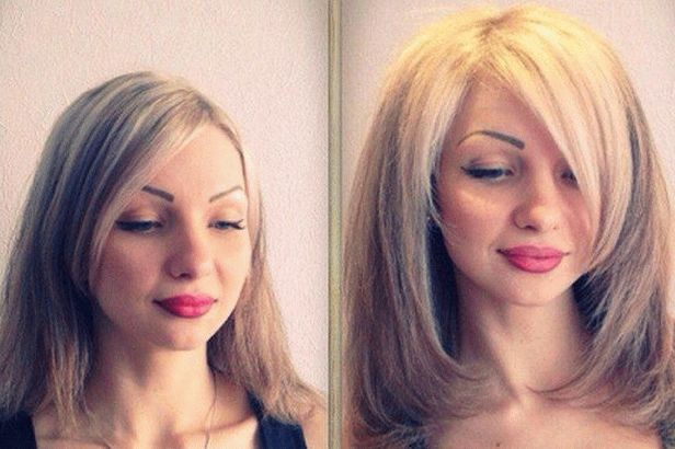 aumento del volumen basal